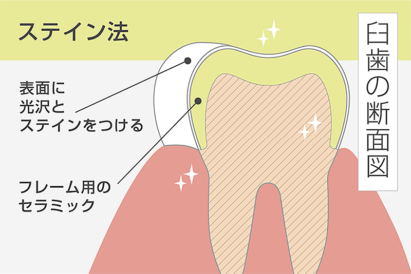 スタンダードプラン
